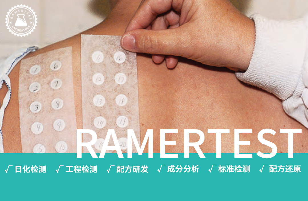 斑贴试验如何揪出化妆品不良反应？
